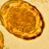 coccidios