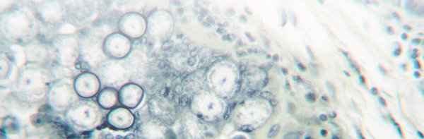 coccidiosis aviar